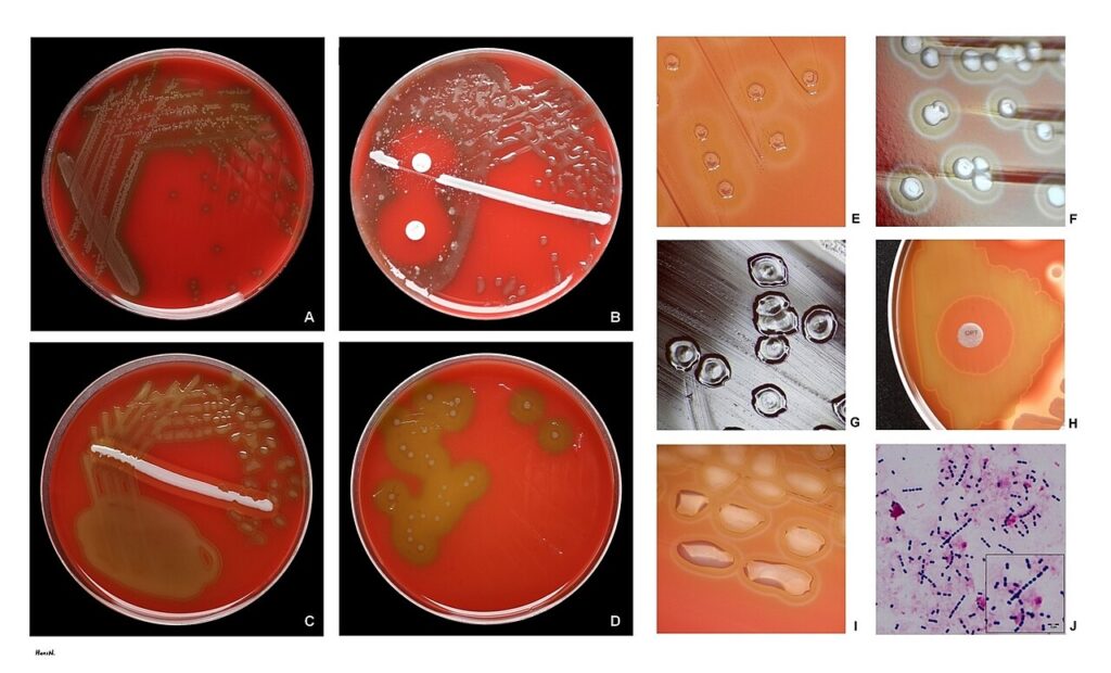 pneumococcal diseases