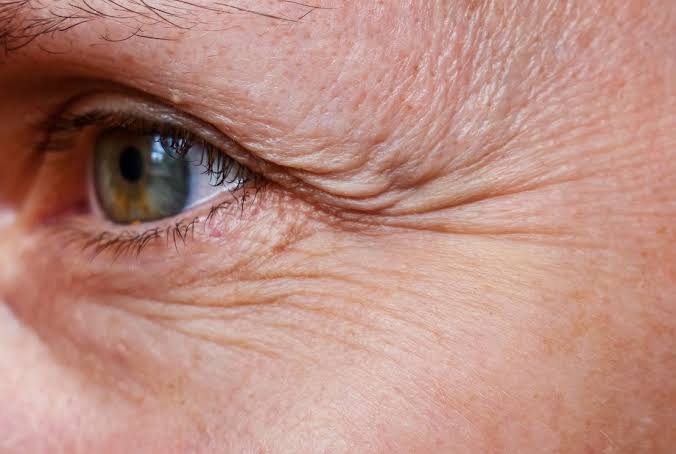 Which vitamin deficiency causes wrinkles on the face? What should you eat to eliminate wrinkles? Learn more here