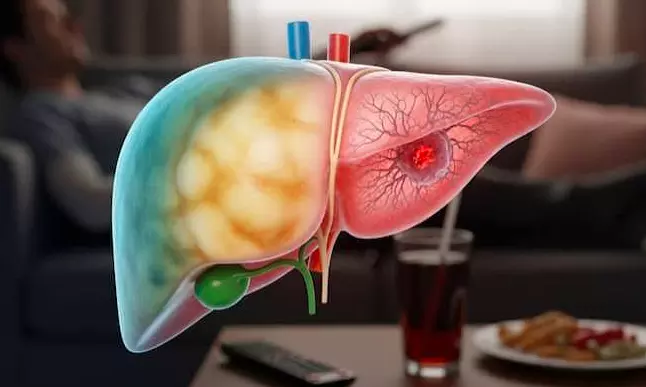 fatty liver