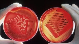 A first step towards a universal vaccine against pneumonia, meningitis