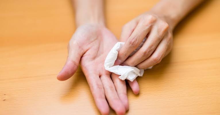 Sweaty hands? Here's what your body might be trying to tell you